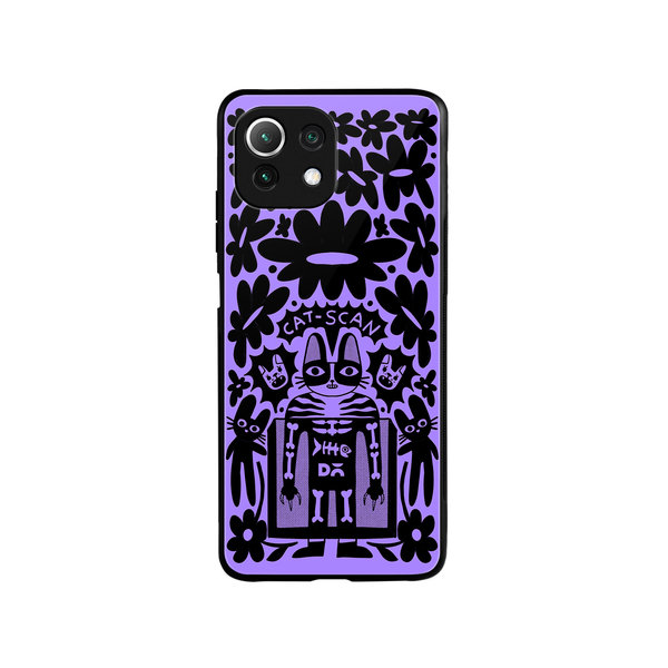 

DailyObjects Cat Scan Glass Case Cover For Xiaomi Mi 11 Lite